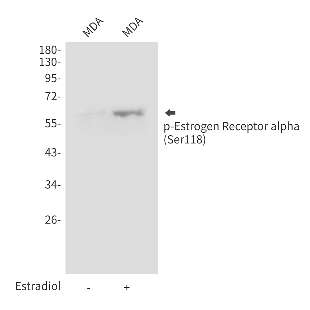 Rabbit Polyclonal Antibody to Phospho-Estrogen Receptor alpha (Ser118)