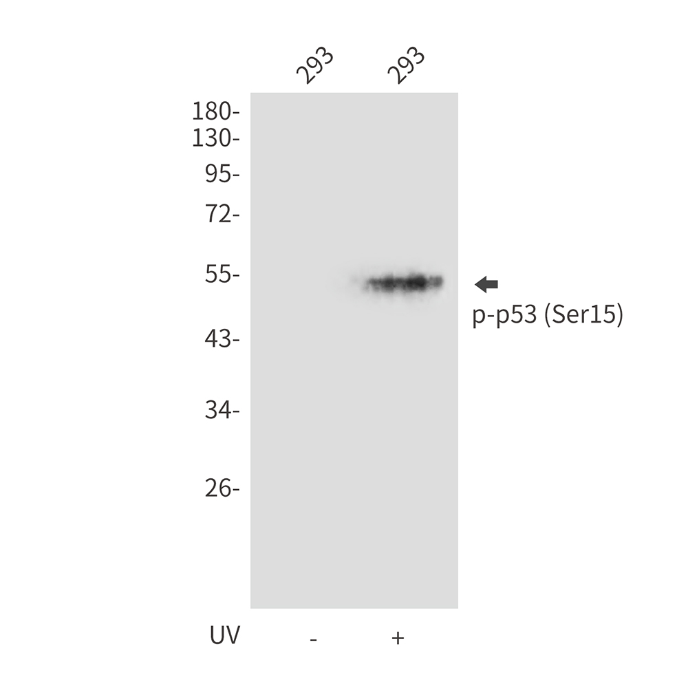 Rabbit Polyclonal Antibody to Phospho-p53 (Ser15)