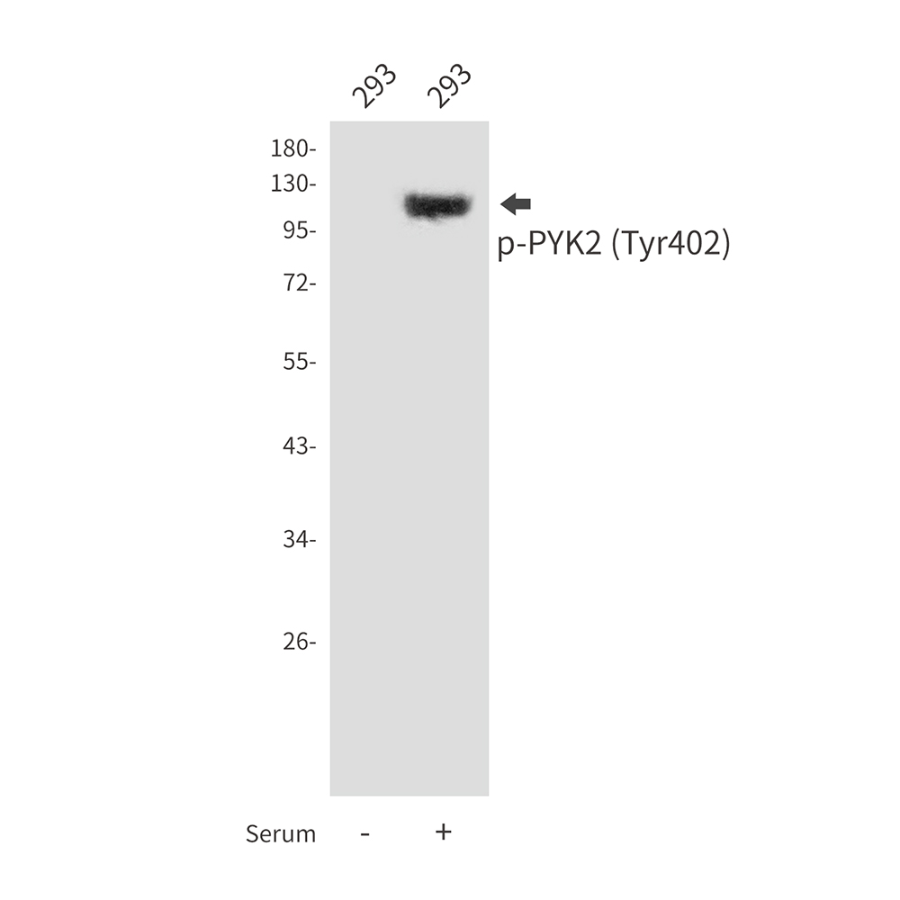 Rabbit Polyclonal Antibody to Phospho-PYK2 (Tyr402)