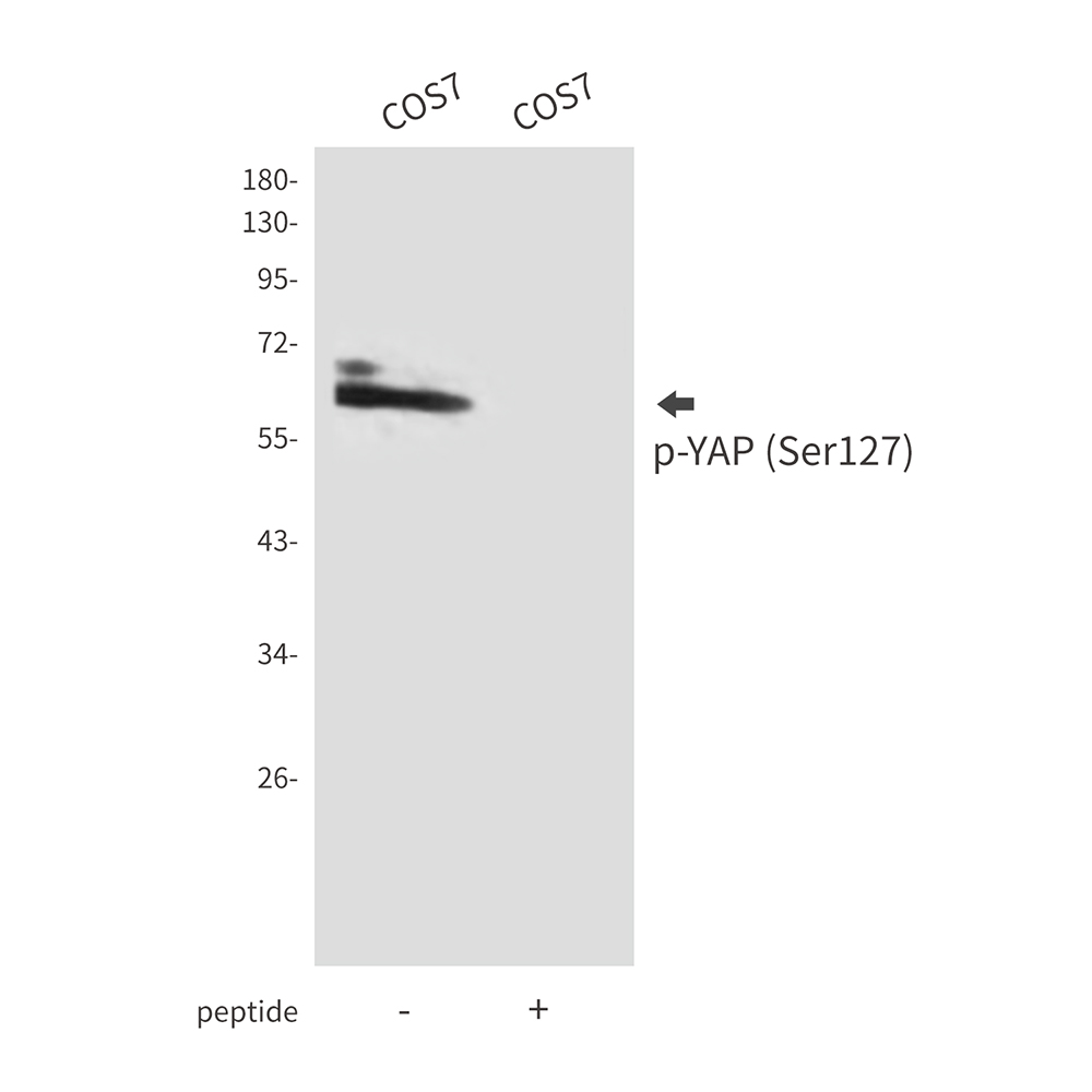 Rabbit Polyclonal Antibody to Phospho-YAP (Ser127)