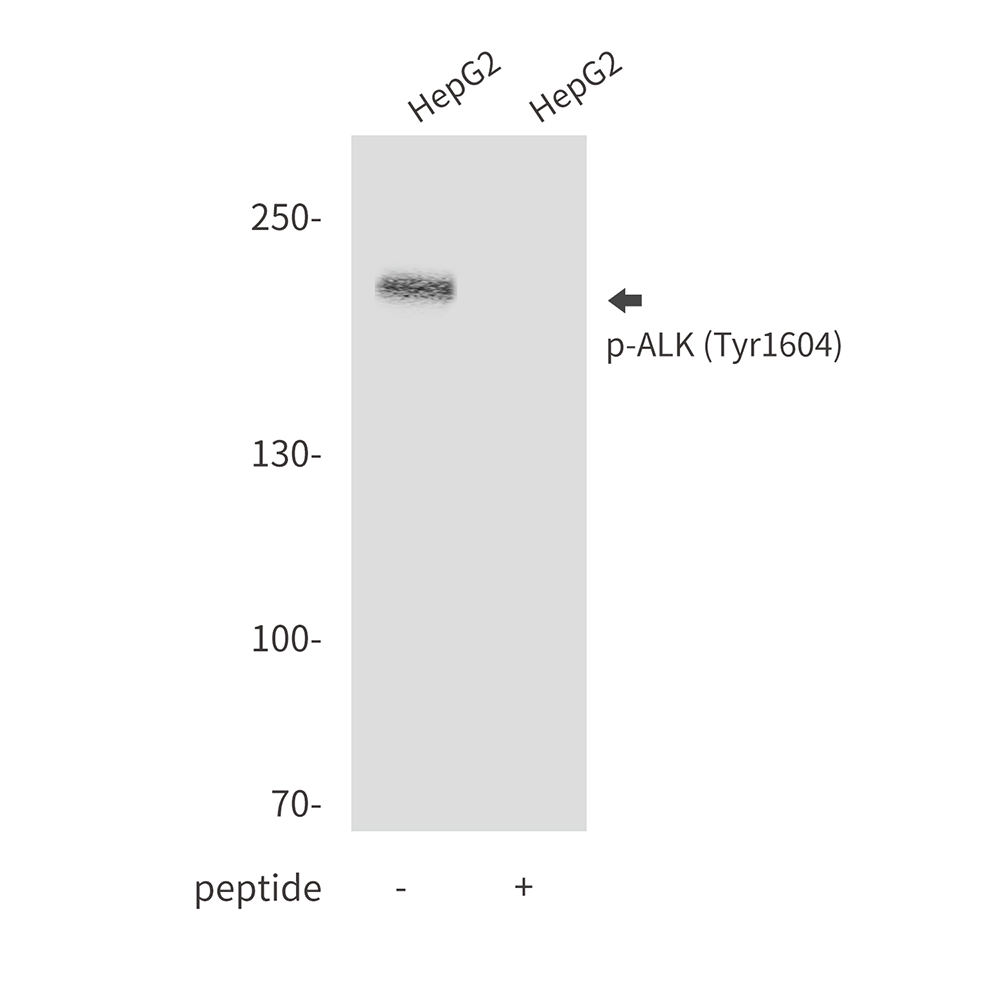 Rabbit Polyclonal Antibody to Phospho-ALK (Tyr1604)