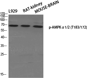 Rabbit Polyclonal Antibody to Phospho-AMPK alpha 1/2 (Thr183/Thr172)