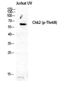 Rabbit Polyclonal Antibody to Phospho-Chk2 (Thr68)