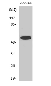 Rabbit Polyclonal Antibody to Phospho-AKT (Thr308)