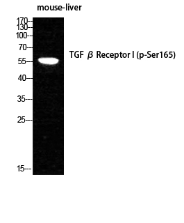 Rabbit Polyclonal Antibody to Phospho-TGF beta Receptor I (Ser165)