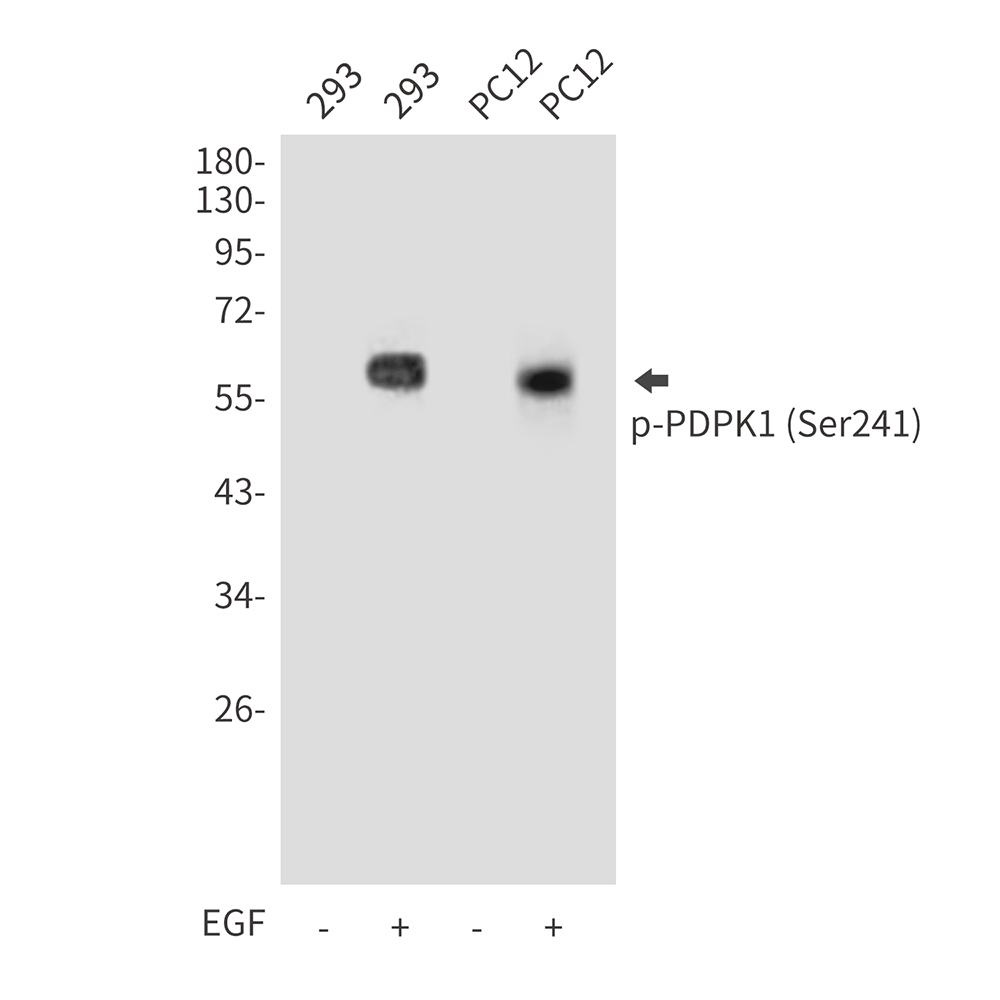 Rabbit Polyclonal Antibody to Phospho-PDPK1 (Ser241)