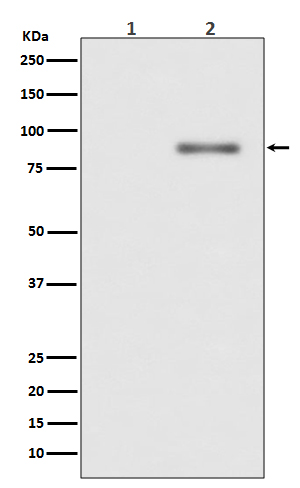 Rabbit Polyclonal Antibody to Phospho-PKC alpha (Thr638)