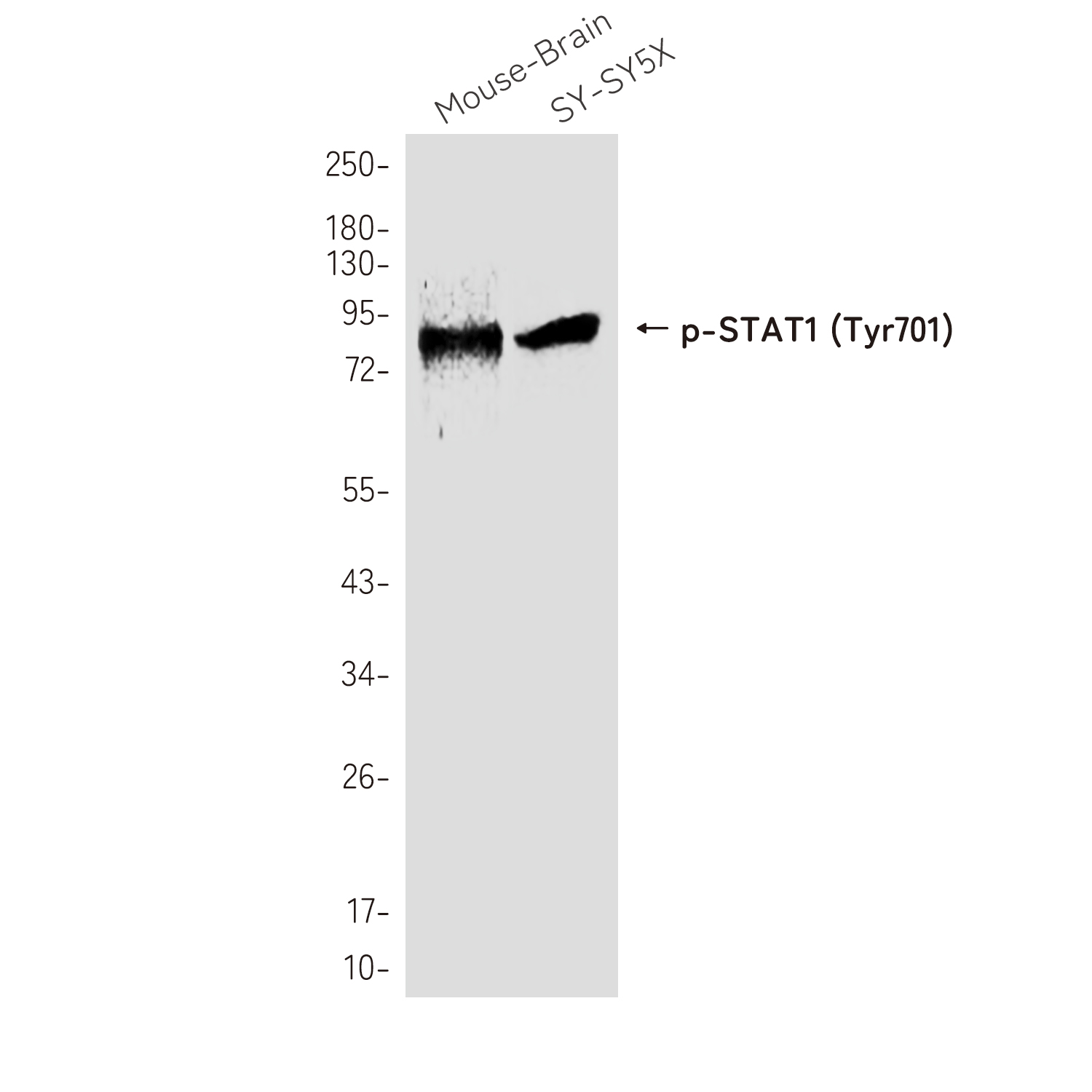 Rabbit Polyclonal Antibody to Phospho-STAT1 (Tyr701)
