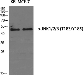 Rabbit Polyclonal Antibody to Phospho-JNK (Thr183/Tyr185)