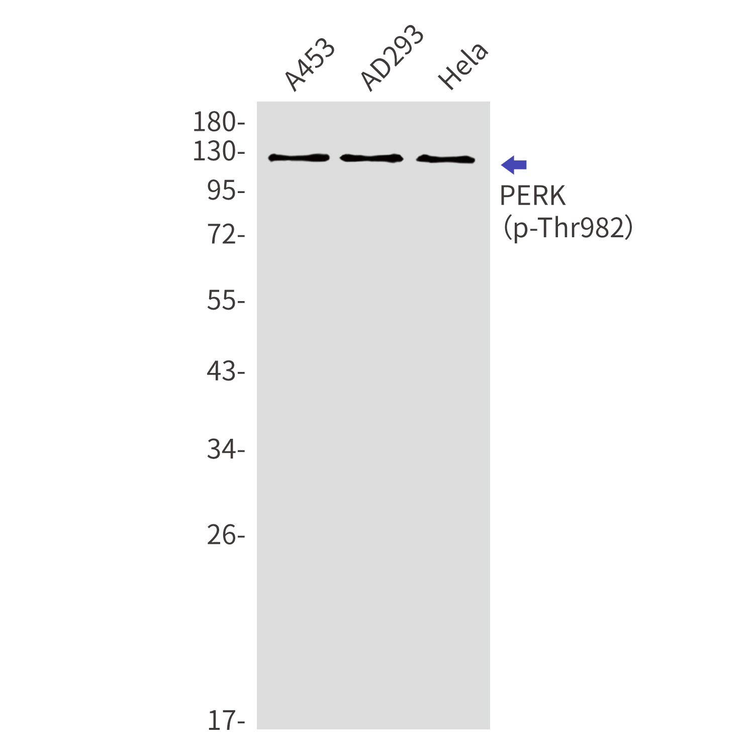 Rabbit Polyclonal Antibody to Phospho-PERK (Thr982)
