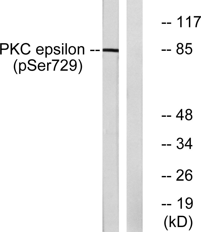 Rabbit Polyclonal Antibody to Phospho-PKC epsilon (Ser729)