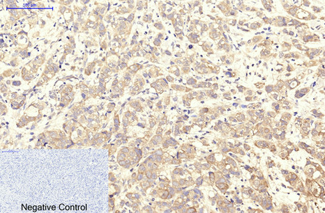 Mouse Monoclonal Antibody to Integrin alpha Iib