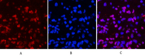 Mouse Monoclonal Antibody to Progesterone Receptor