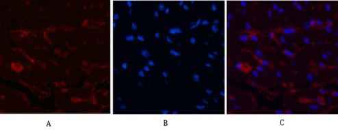 Mouse Monoclonal Antibody to CD1a