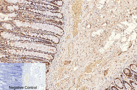 Mouse Monoclonal Antibody to CD2