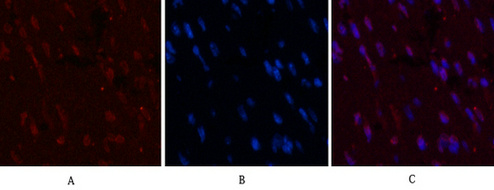 Mouse Monoclonal Antibody to CD5