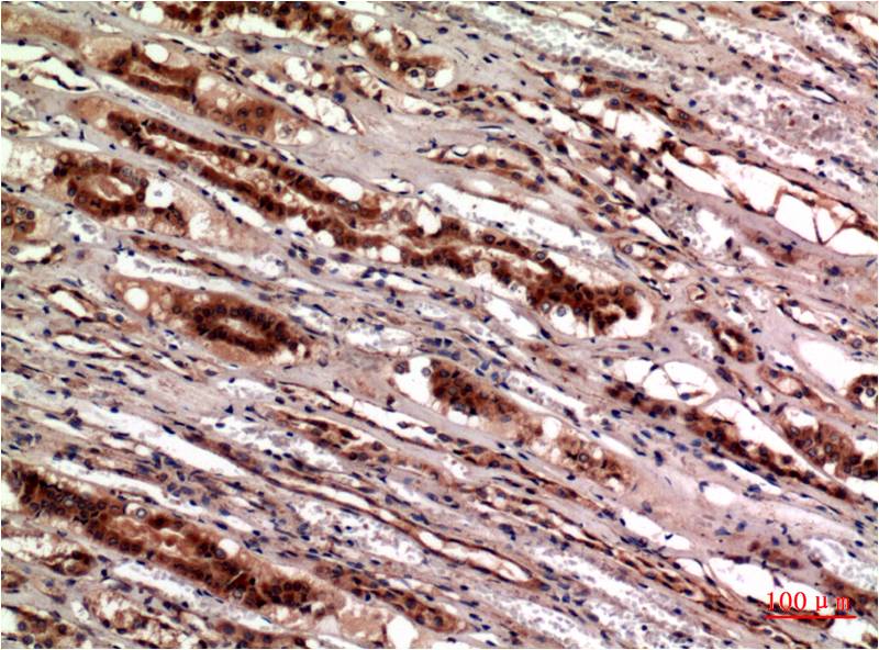 Mouse Monoclonal Antibody to Cystatin C