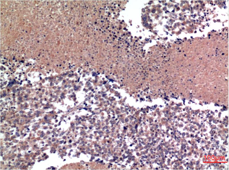 Mouse Monoclonal Antibody to Cyclin B1