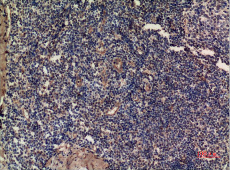 Mouse Monoclonal Antibody to ERK1