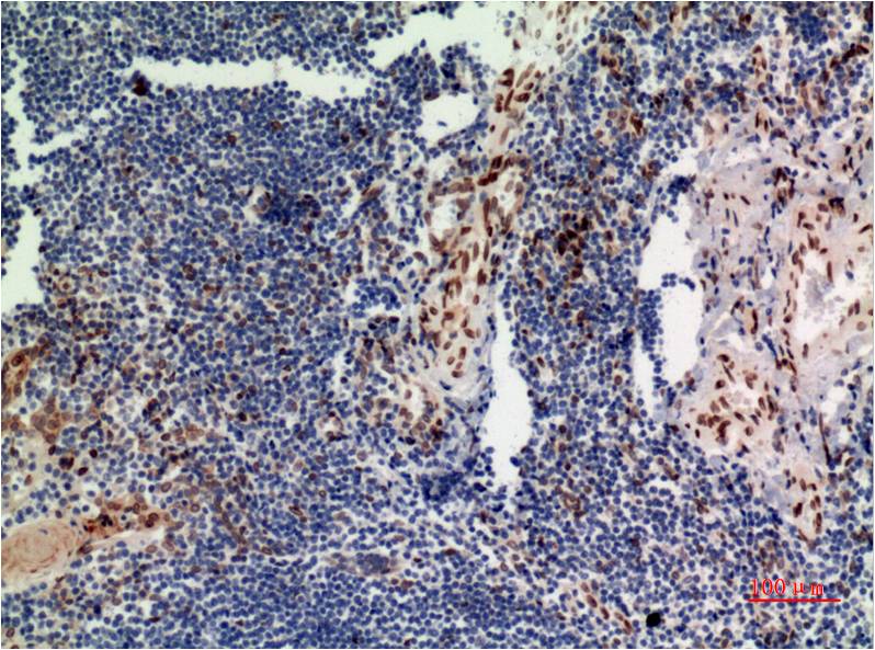 Mouse Monoclonal Antibody to ERK1