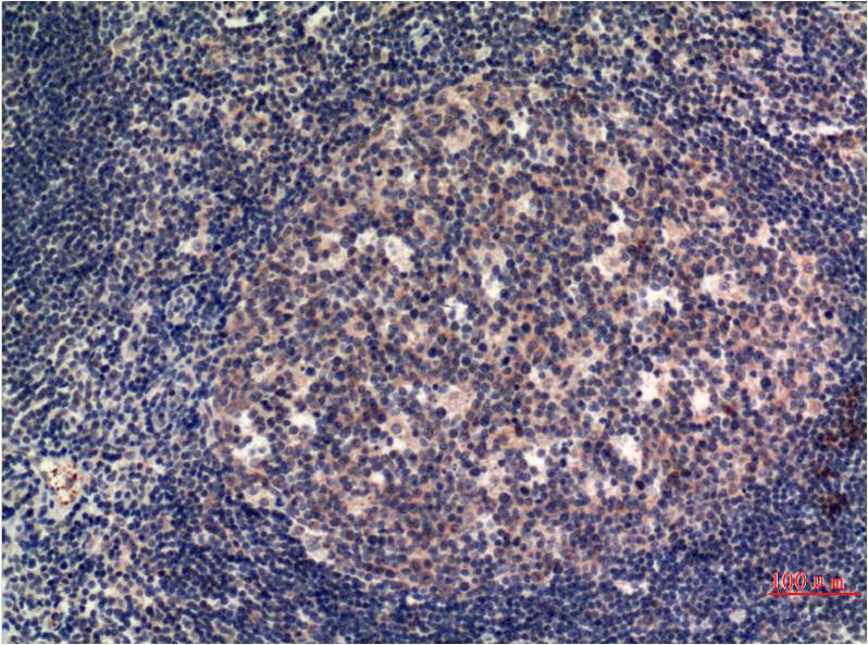 Mouse Monoclonal Antibody to MLKL