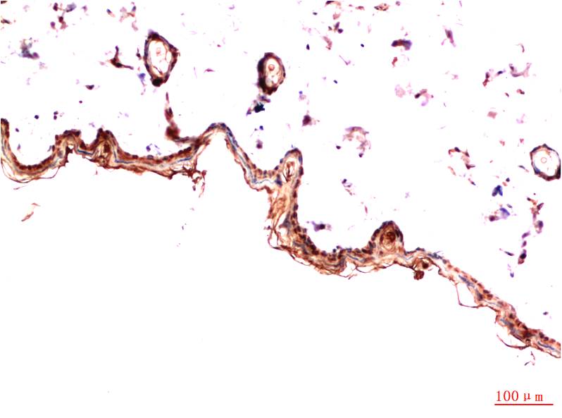 Mouse Monoclonal Antibody to PDGFR alpha