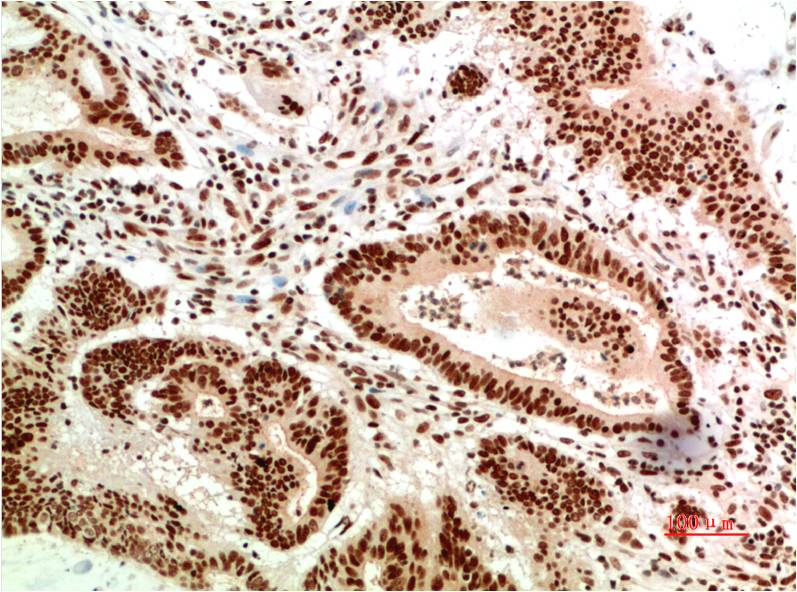 Mouse Monoclonal Antibody to ATM