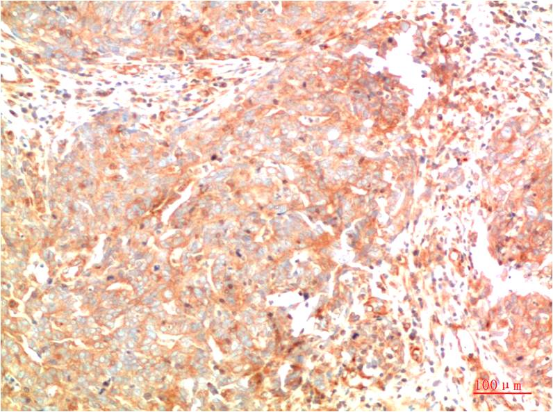 Mouse Monoclonal Antibody to ATG7