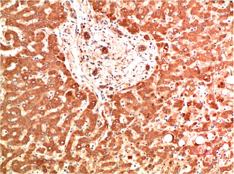 Mouse Monoclonal Antibody to Collagen IV alpha 1