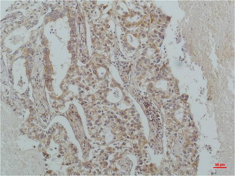 Mouse Monoclonal Antibody to IKB beta