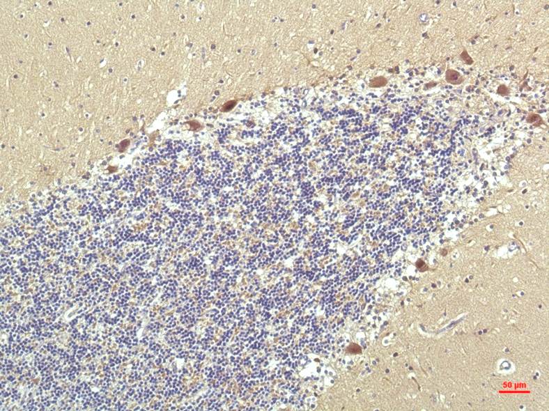 Mouse Monoclonal Antibody to PPAR delta