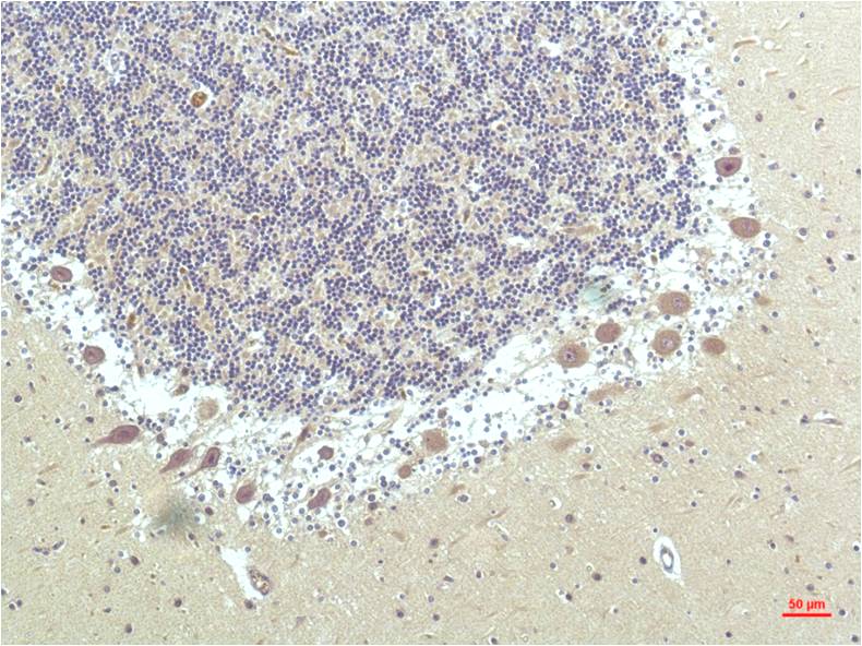 Mouse Monoclonal Antibody to PPAR delta