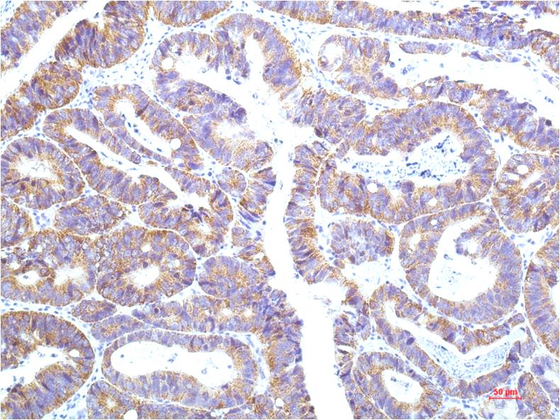 Mouse Monoclonal Antibody to Cytokeratin 8