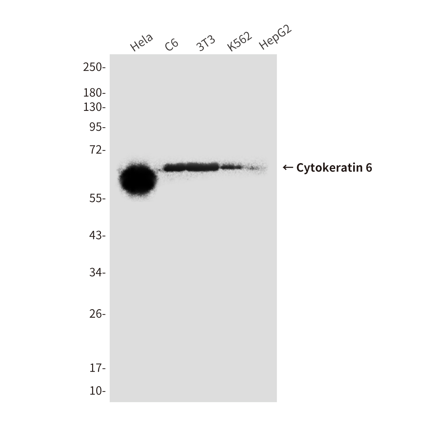 Mouse Monoclonal Antibody to Cytokeratin 6