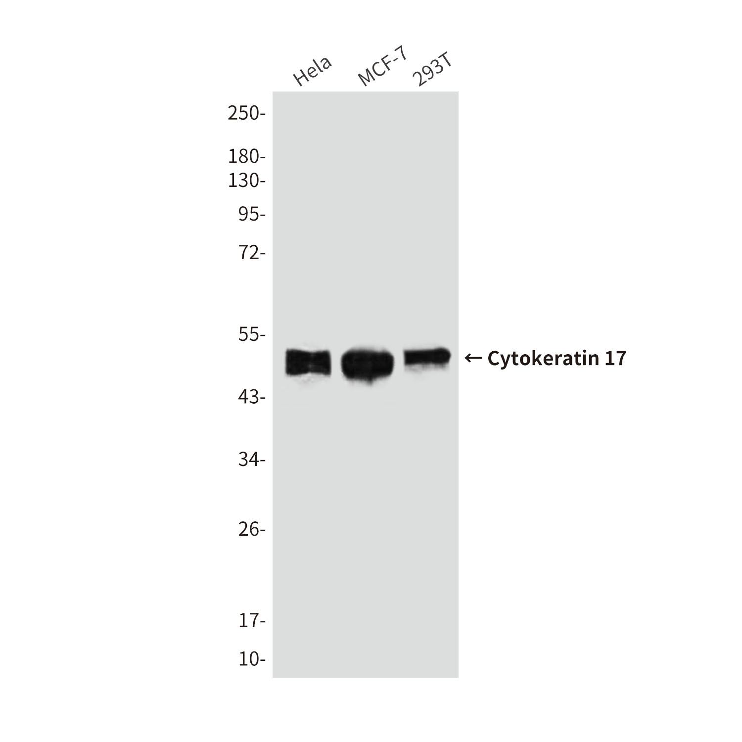Mouse Monoclonal Antibody to Cytokeratin 17