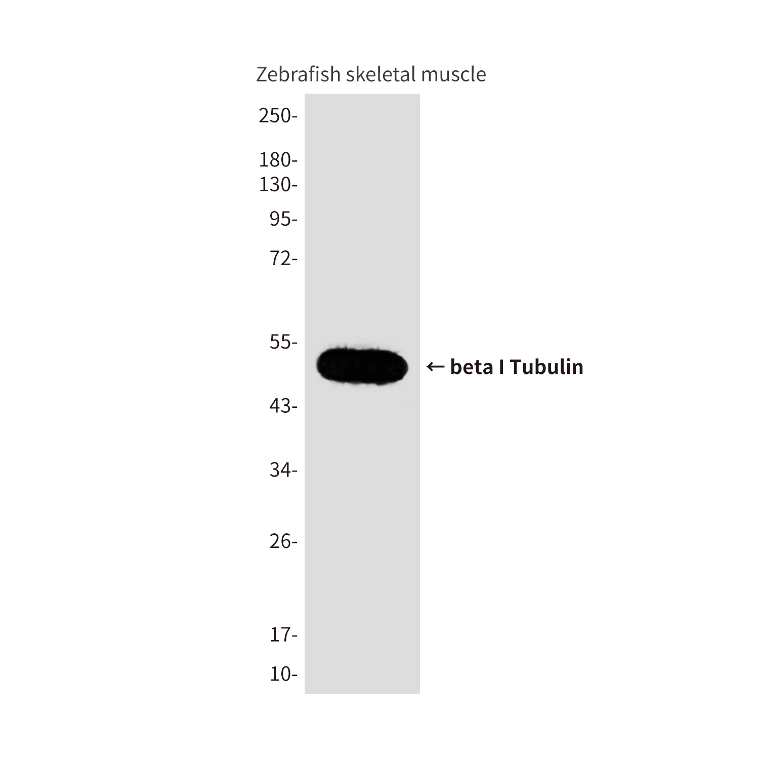 Mouse Monoclonal Antibody to beta I Tubulin