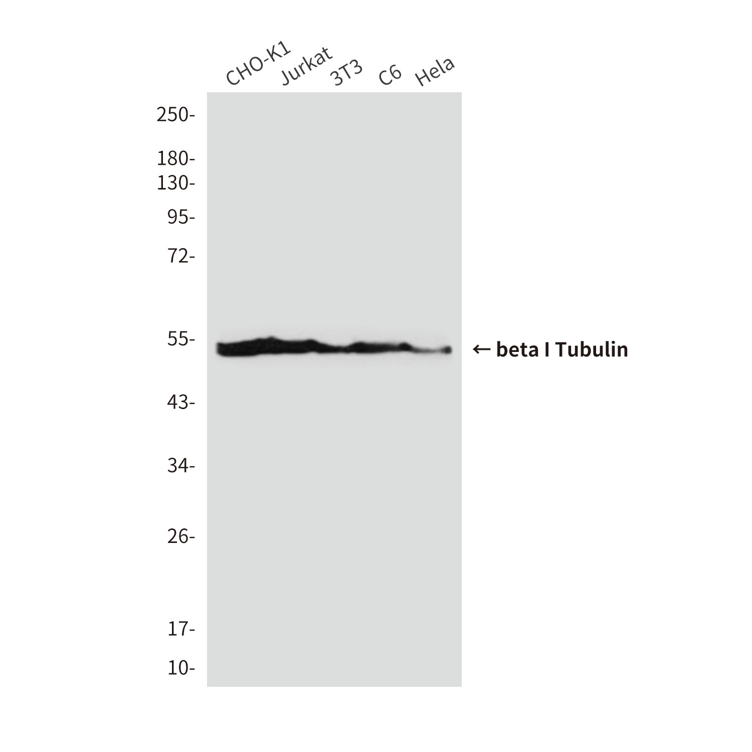 Mouse Monoclonal Antibody to beta I Tubulin
