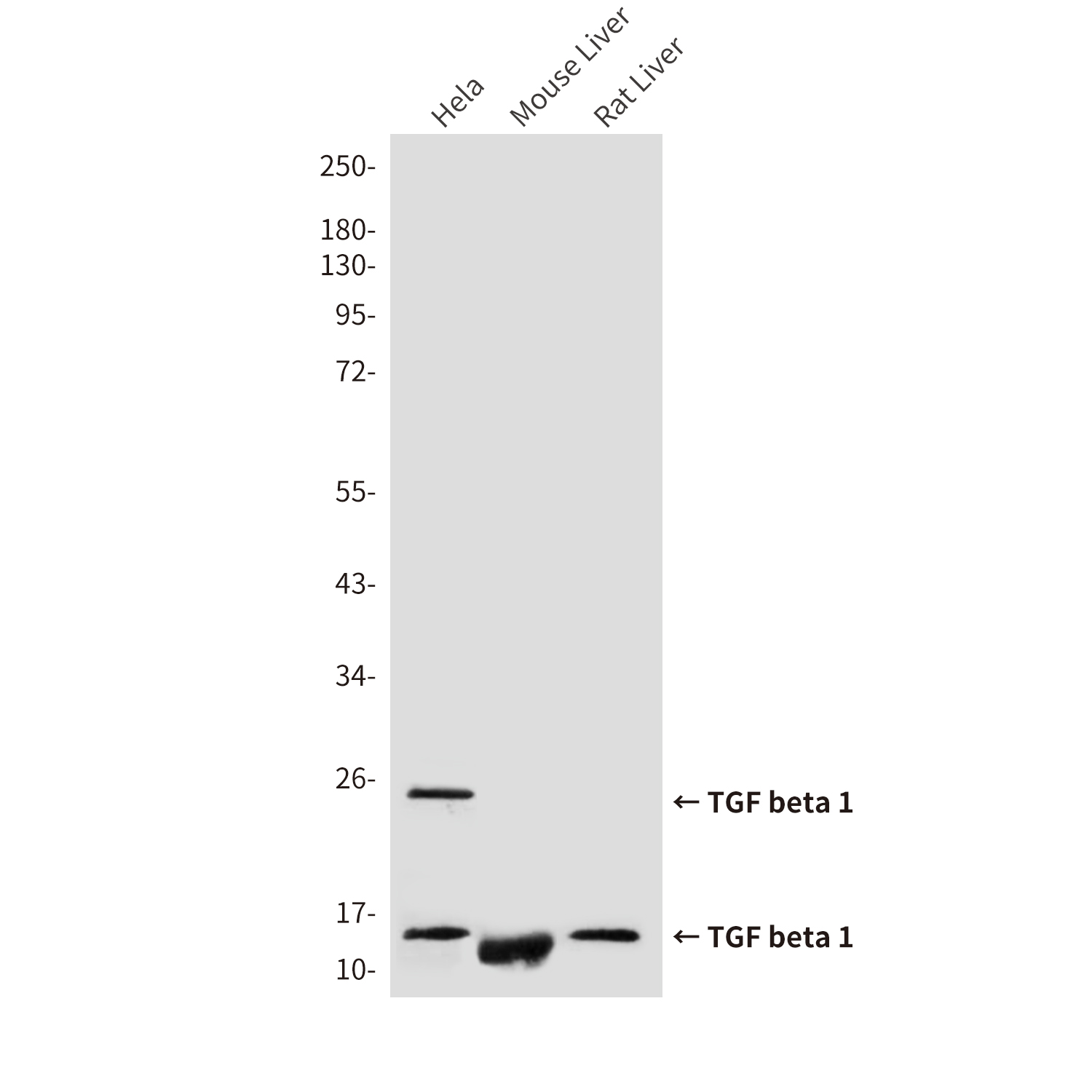 Mouse Monoclonal Antibody to TGF beta 1