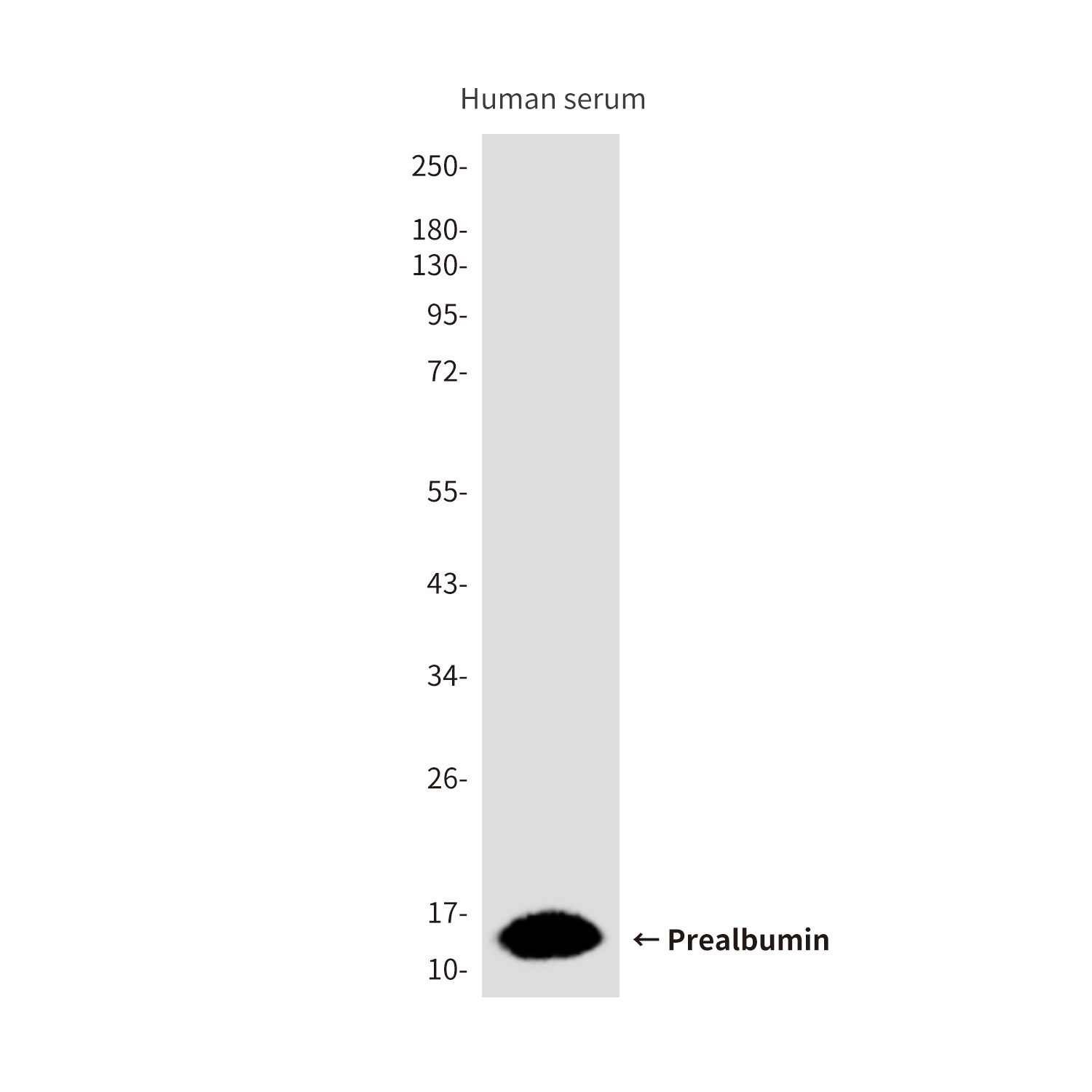 Mouse Monoclonal Antibody to Prealbumin