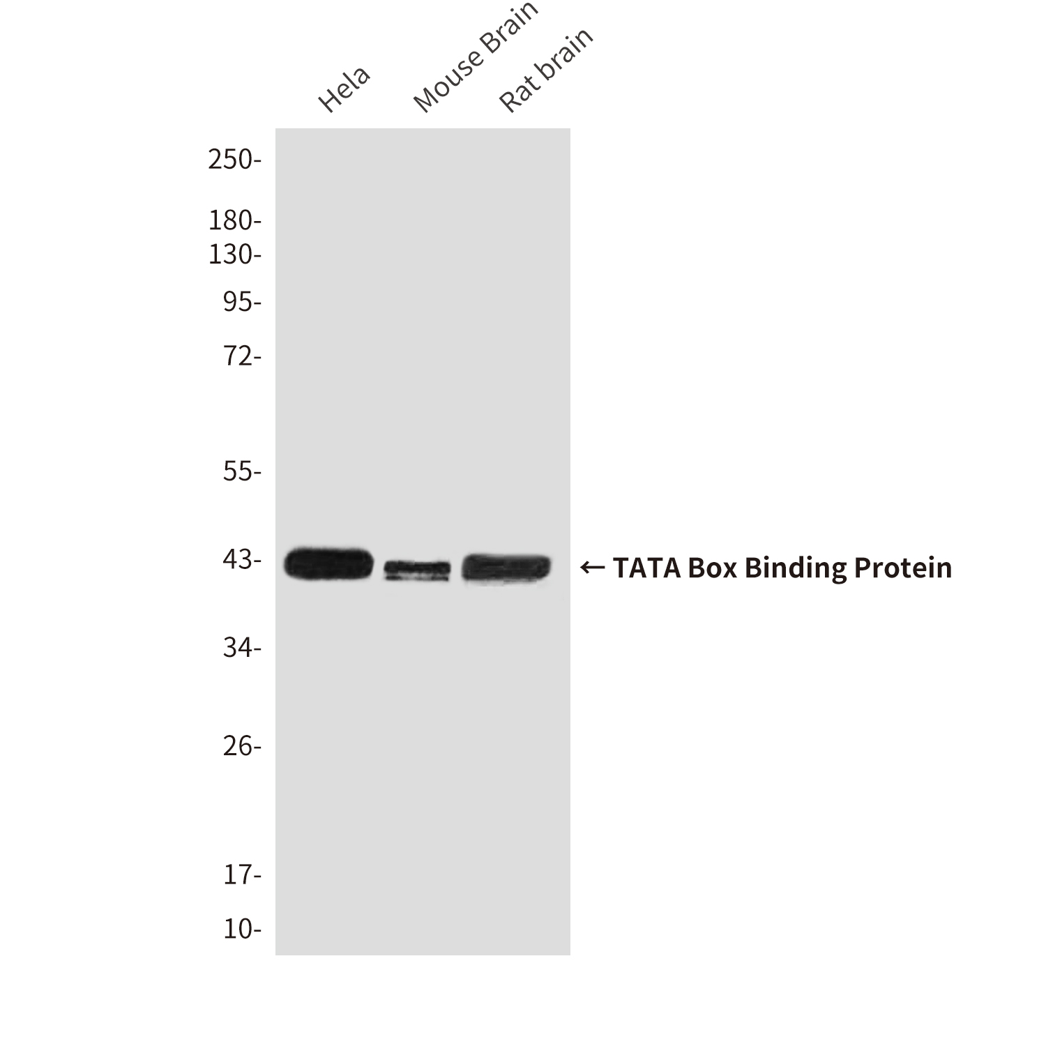 Mouse Monoclonal Antibody to TATA Box Binding Protein
