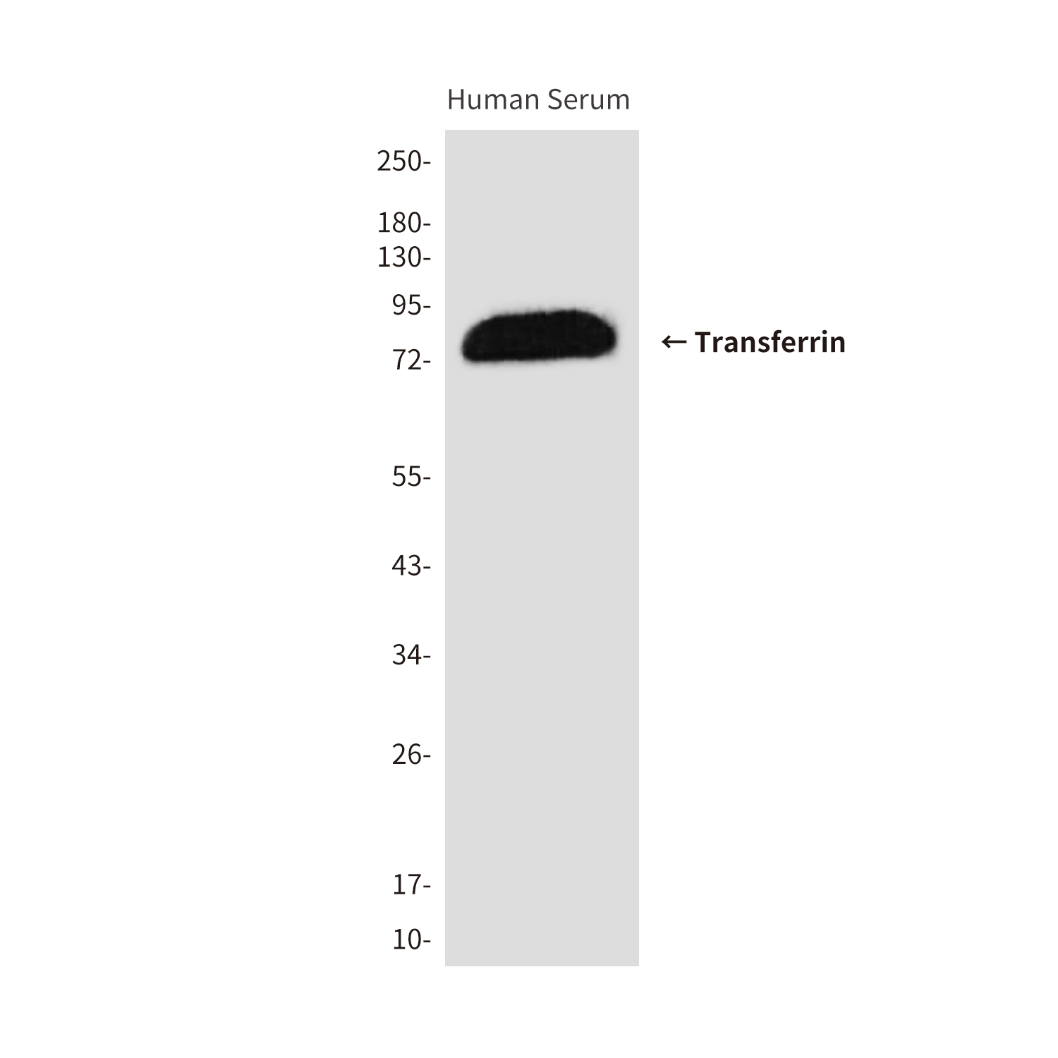 Mouse Monoclonal Antibody to Transferrin