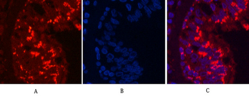 Mouse Monoclonal Antibody to CD68