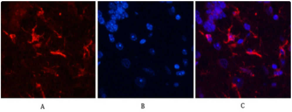 Mouse Monoclonal Antibody to GFAP
