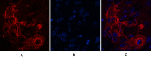 Mouse Monoclonal Antibody to Carcino Embryonic Antigen CEA