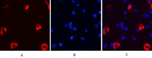 Mouse Monoclonal Antibody to MAP2