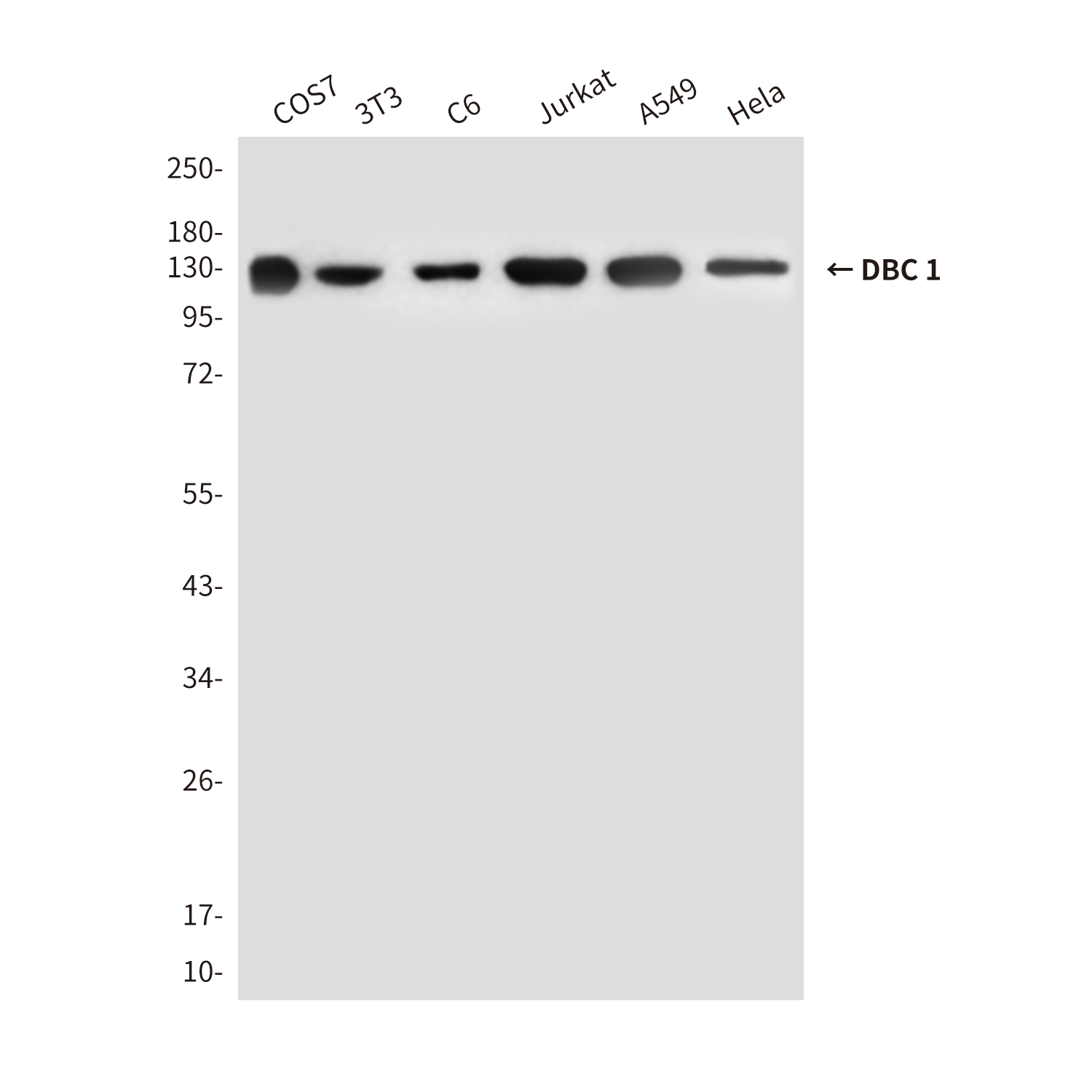Mouse Monoclonal Antibody to DBC 1