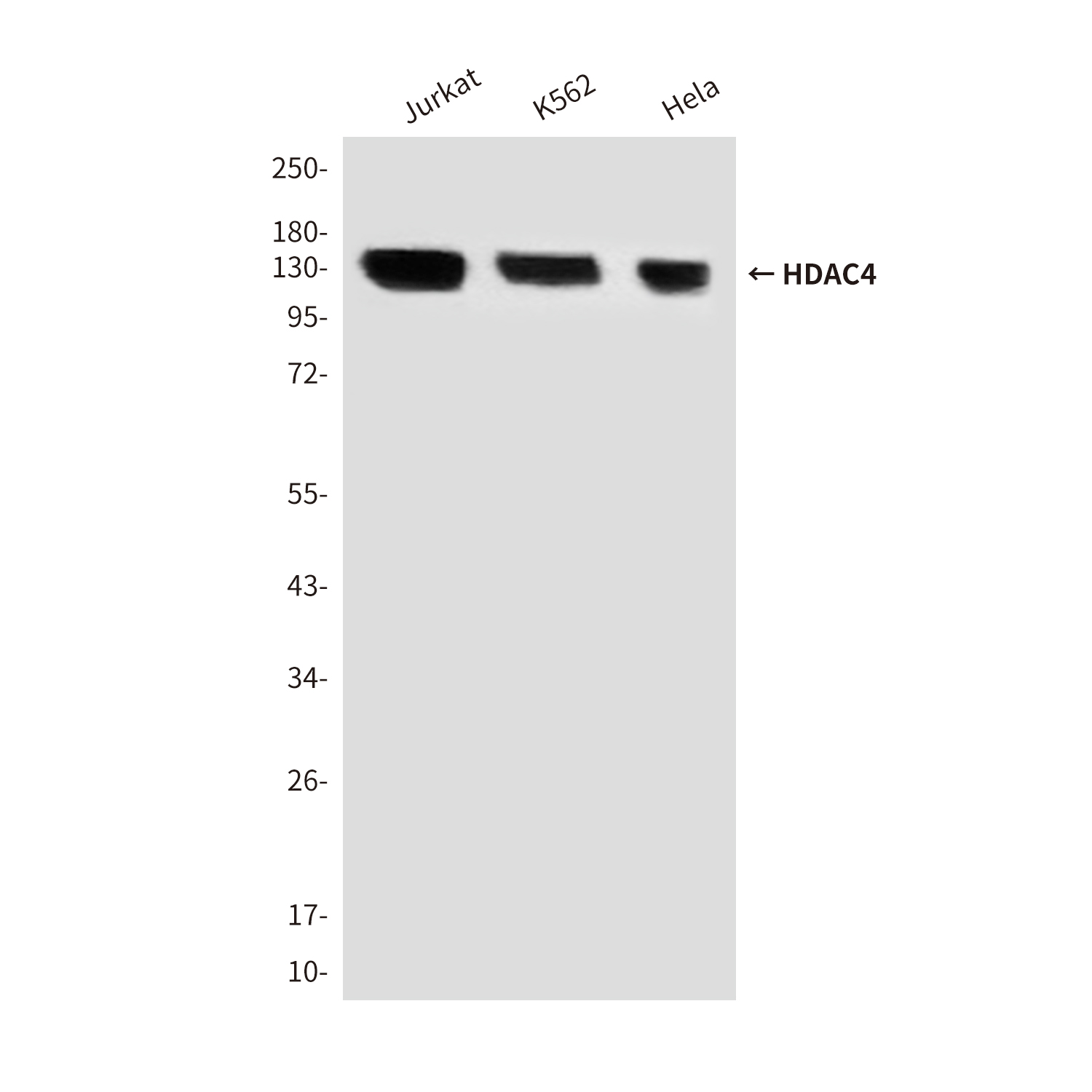 Mouse Monoclonal Antibody to HDAC4