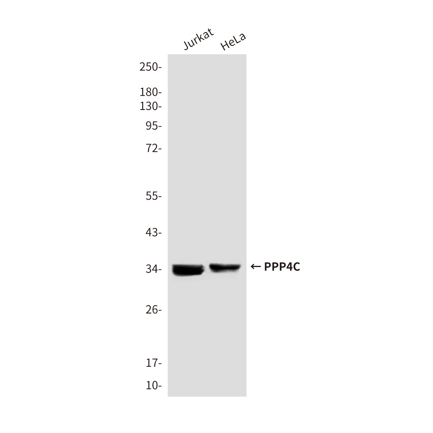 Mouse Monoclonal Antibody to PPP4C