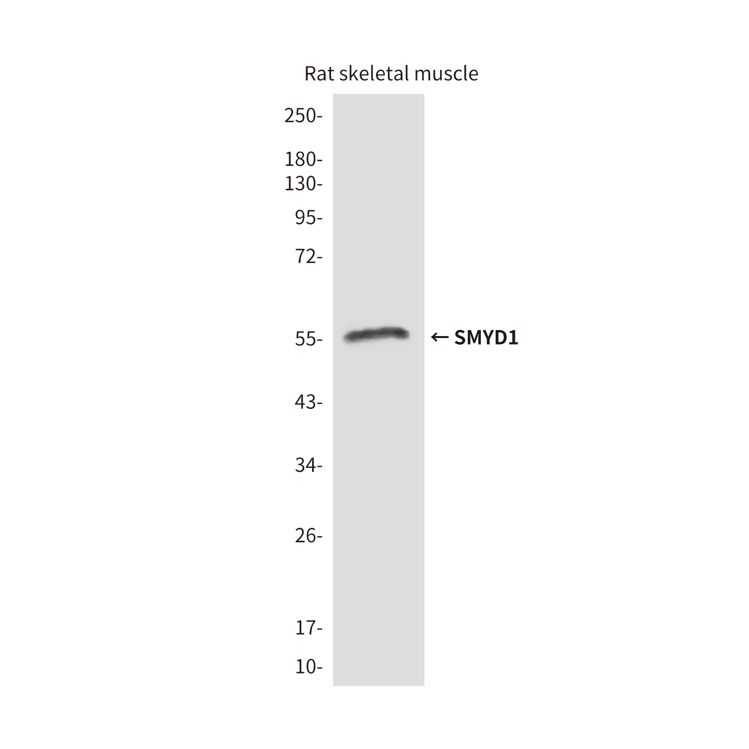 Mouse Monoclonal Antibody to SMYD1