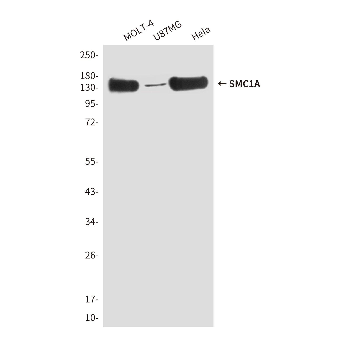 Mouse Monoclonal Antibody to SMC1A